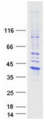 Coomassie blue staining of purified IL1B protein.